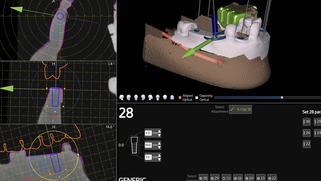 X-Nav Photo 1